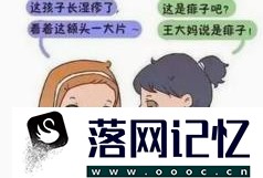 痱子和湿疹的区别优质