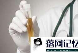 尿液报告单怎么看（干化学方法和镜检）优质