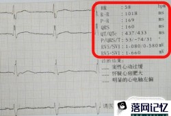 解读体检报告之心电图优质