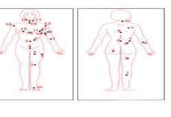 全身痣相图解测命运（痣的位置不同，命运不同）