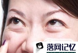 眼袋是怎么形成的 3方法消除眼袋优质