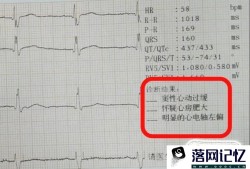 解读体检报告之心电图优质