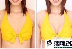 怎么看乳房下垂的程度?优质