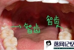 天天都能做的口腔保健方法细节是关键优质