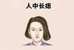 人中有痣怎么看是不是恶痣