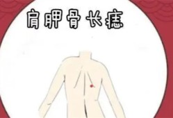 男人背上有痣代表什么