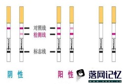 异位妊娠的检查优质