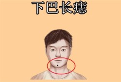 男人有一痣必有财