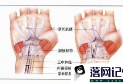 患有鼠标手应该怎么治疗优质