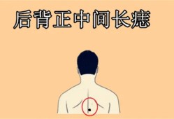 后背有福痣解析男人