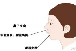 怎样矫正宝宝用口呼吸的习惯