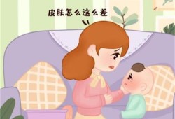 冬天新生儿皮肤如何正确护理