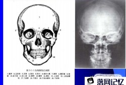 记住几个头颅X线常见体位，轻松工作优质