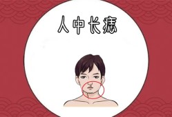 男人苦命痣长在哪里