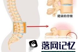 腰疼吃什么药效果最好优质