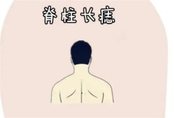 男人背上有痣代表什么