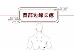 后背有福痣解析男人