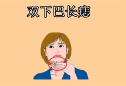 女人脸上长痣好不