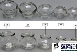 教你在家正确拔火罐优质