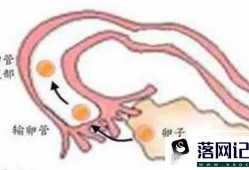 如何判断输卵管是否通畅？揭示4大检查方法优质