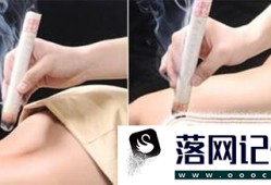 艾灸的基本方法优质