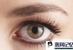 天津开眼角整形哪个医院好优质