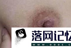 女性必知：乳腺癌早期五大症状优质