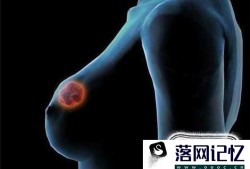 乳房有肿块是什么原因？该如何消除乳房肿块？优质