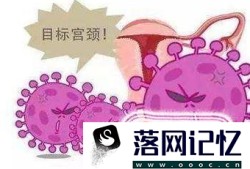 感染HPV病毒一定会得宫颈癌吗优质