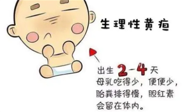 新生儿黄疸怎么办  第3张