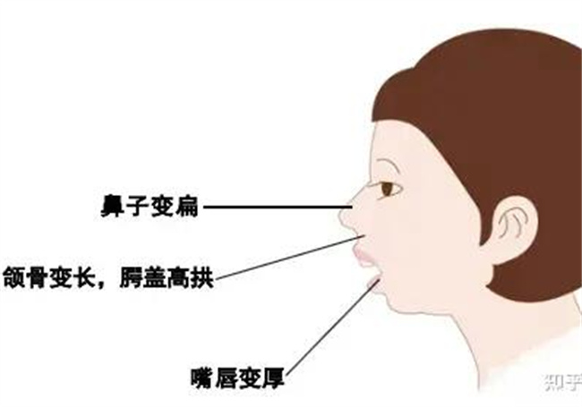 怎样矫正宝宝用口呼吸的习惯  第3张