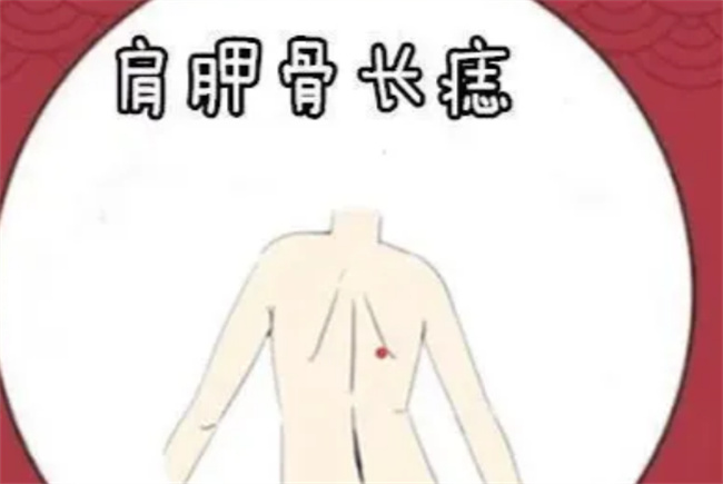 男人背上有痣代表什么  第2张