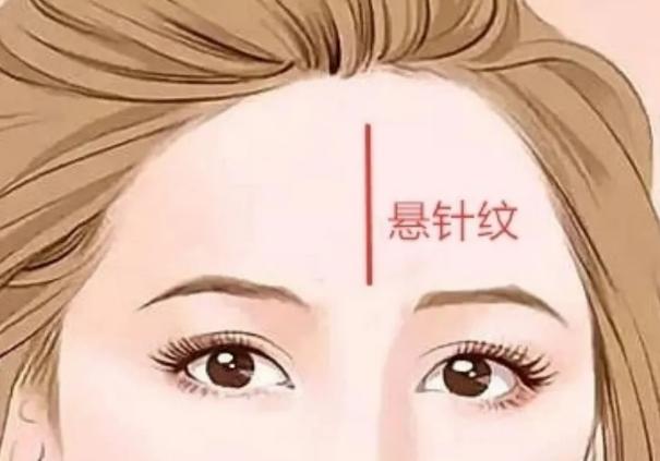 女人悬针纹怎么变福针纹  第2张