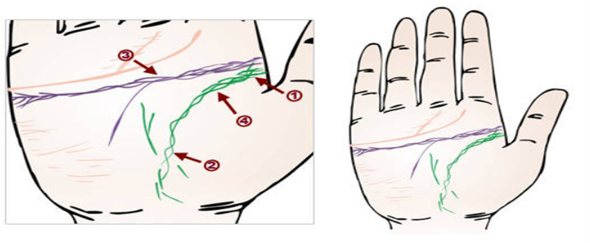 手上杂纹多的命不好吗（不一定）  第3张