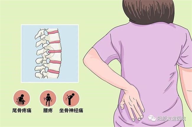 腰间盘突出症不花钱、最简单的治疗方式  第3张