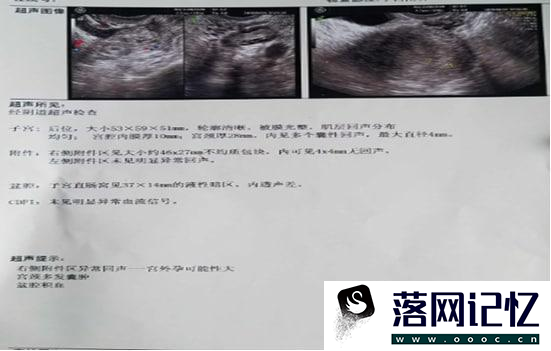 怀孕59天孕酮直线下降的原因优质  第2张