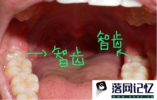 天天都能做的口腔保健方法细节是关键优质  第2张