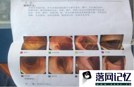 慢性结肠炎能吃菠菜吗优质  第1张