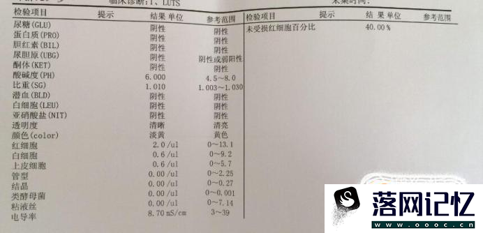 尿检报告单怎么看优质  第3张