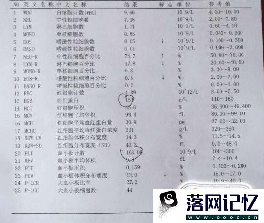 尿检报告单怎么看优质  第7张