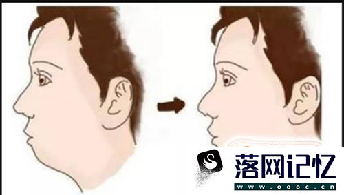 用鼻子和用嘴呼吸对脸型真的有影响么？优质  第1张