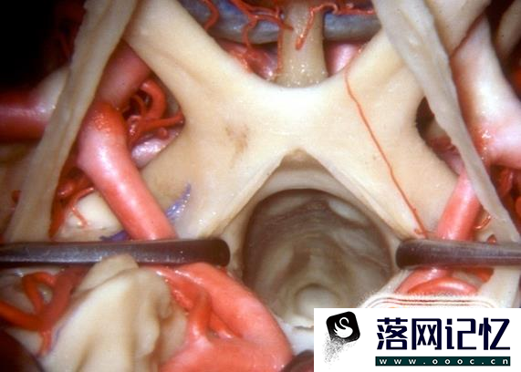 人类大脑十大三维解剖图优质  第2张