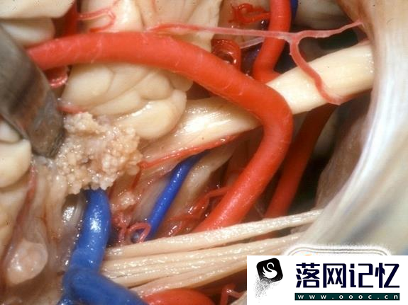 人类大脑十大三维解剖图优质  第4张