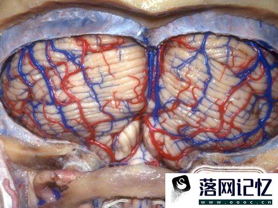 人类大脑十大三维解剖图优质  第10张