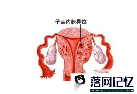 月经量少有什么危害优质  第2张