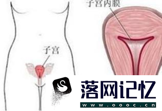 子宫内膜厚度正常值优质  第1张