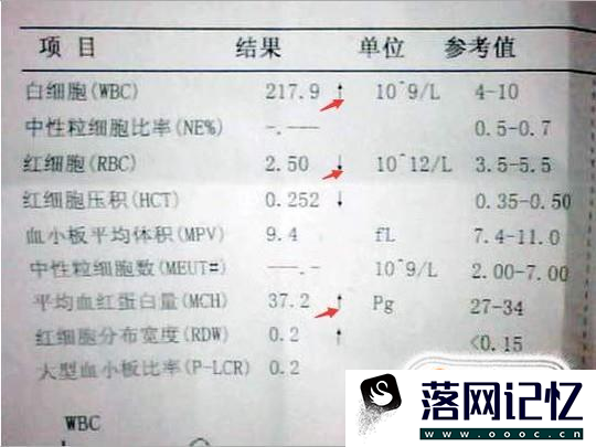 自己读懂血常规检验报告单优质  第3张