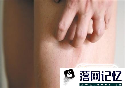 大腿内侧痒是什么病啊？最近痒得厉害总想抓优质  第2张