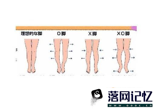 如何快速矫正腿型优质  第2张