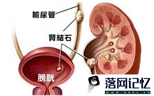 为啥一喝水就想排尿是什么原因?优质  第4张